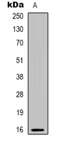 PBOV1 Rabbit Polyclonal Antibody