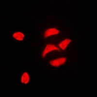 PBOV1 Rabbit Polyclonal Antibody