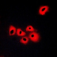 SERINC1 Rabbit Polyclonal Antibody