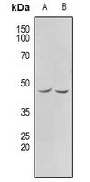 CHKB Rabbit Polyclonal Antibody
