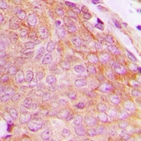 CHKB Rabbit Polyclonal Antibody