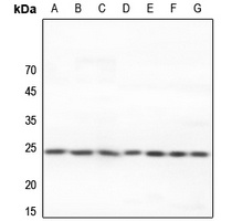 Adenylate Kinase 6 Rabbit Polyclonal Antibody