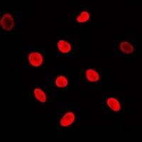 Adenylate Kinase 6 Rabbit Polyclonal Antibody