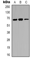IRAK3 Rabbit Polyclonal Antibody