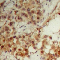 CDC6 Rabbit Polyclonal Antibody