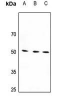 Beta-1 Adrenergic Receptor Rabbit Polyclonal Antibody