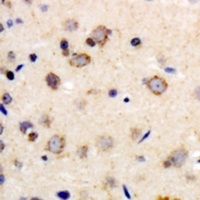 Beta-1 Adrenergic Receptor Rabbit Polyclonal Antibody