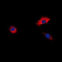 Beta-1 Adrenergic Receptor Rabbit Polyclonal Antibody