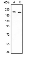 DIDO1 Rabbit Polyclonal Antibody