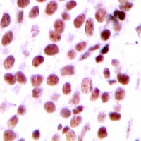 DIDO1 Rabbit Polyclonal Antibody