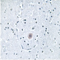 Arylsulfatase I Antibody