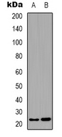 BCAS4 Rabbit Polyclonal Antibody
