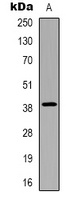 CHST13 Rabbit Polyclonal Antibody