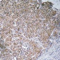 CHST13 Rabbit Polyclonal Antibody