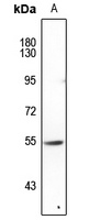 FOXN4 Rabbit Polyclonal Antibody