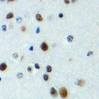 FOXN4 Rabbit Polyclonal Antibody