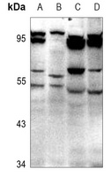 GABRD Rabbit Polyclonal Antibody