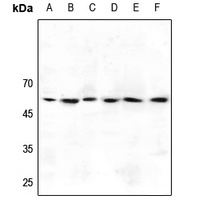 GABRG1 Rabbit Polyclonal Antibody