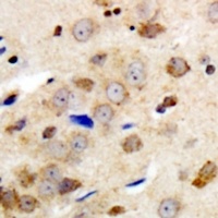 GABRG1 Rabbit Polyclonal Antibody