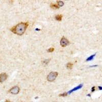 NBPF5 Rabbit Polyclonal Antibody