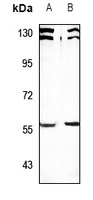 SESN1 Rabbit Polyclonal Antibody
