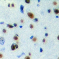 SESN1 Rabbit Polyclonal Antibody