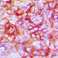 Taurine Transporter Rabbit Polyclonal Antibody