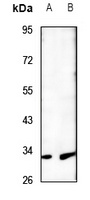 MTIF3 Rabbit Polyclonal Antibody