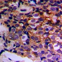 MTIF3 Rabbit Polyclonal Antibody