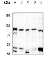 UBE3B Rabbit Polyclonal Antibody