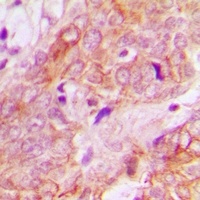 UBE3B Rabbit Polyclonal Antibody