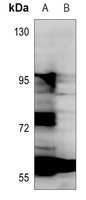 ANGPTL1 Rabbit Polyclonal Antibody