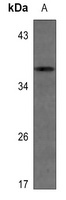 IGFBP1 Antibody