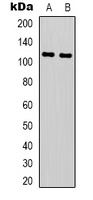 NLRP3 Rabbit Polyclonal Antibody