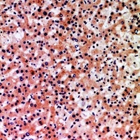 NLRP3 Rabbit Polyclonal Antibody
