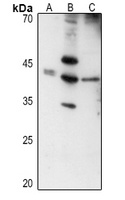 Layilin Rabbit Polyclonal Antibody