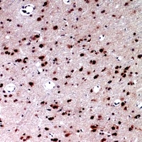 Layilin Rabbit Polyclonal Antibody