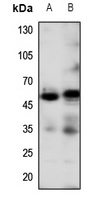 Beta-2 Adrenergic Receptor Rabbit Polyclonal Antibody