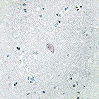 Beta-2 Adrenergic Receptor Rabbit Polyclonal Antibody