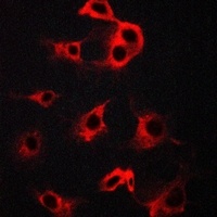 Beta-2 Adrenergic Receptor Rabbit Polyclonal Antibody