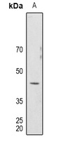 Mu Opioid Receptor Rabbit Polyclonal Antibody