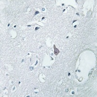Mu Opioid Receptor Rabbit Polyclonal Antibody