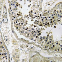 Inhibin beta C Rabbit Polyclonal Antibody