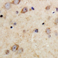 MAP2 Rabbit Polyclonal Antibody