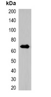 RFP-tag Rabbit Polyclonal Antibody