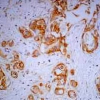 Beta-catenin Mouse Monoclonal Antibody
