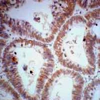 CDX2 Mouse Monoclonal Antibody