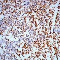 Gamma-enolase Antibody