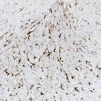 GFAP Antibody
