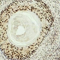Histone H3 (DiMethyl-K27) Antibody
